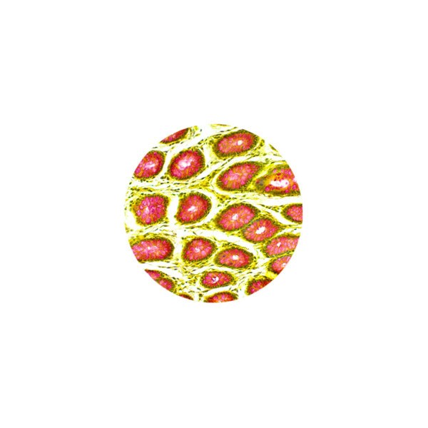 Mucicarmine Stain Kit